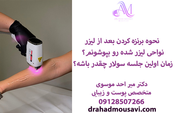 باید ها و نباید های سولاریوم بعد از لیزر موهای زائد