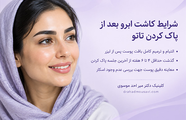 شرایط کاشت ابرو بعد از پاک کردن تاتو