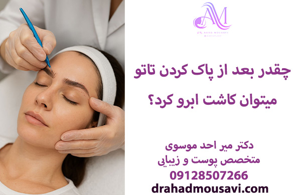 چقدر بعد از پاک کردن تاتو میتوان کاشت ابرو کرد؟