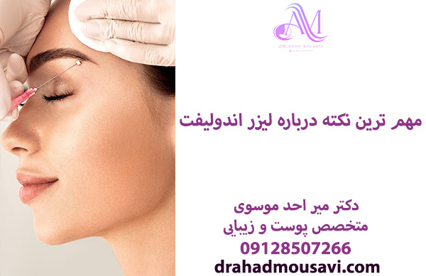 مهم ترین نکته در خصوص لیزر اندولیفت