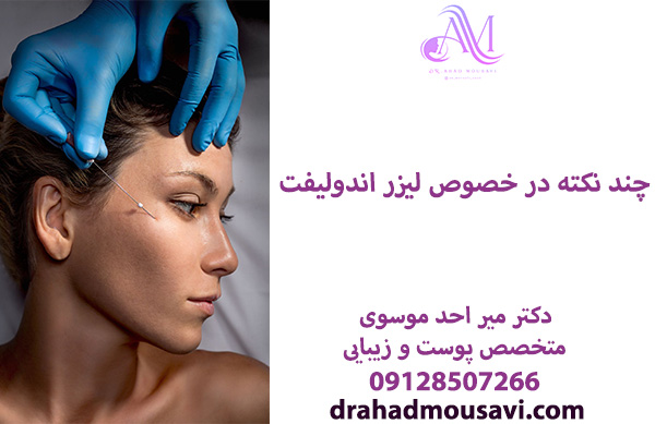 چند نکته در خصوص لیزر اندولیفت